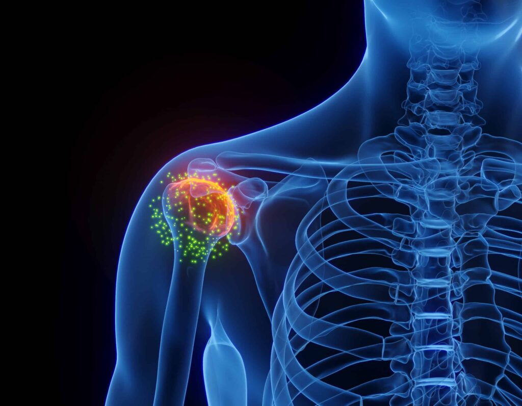 capsutile retractible champigny sur marne laouisset scaled